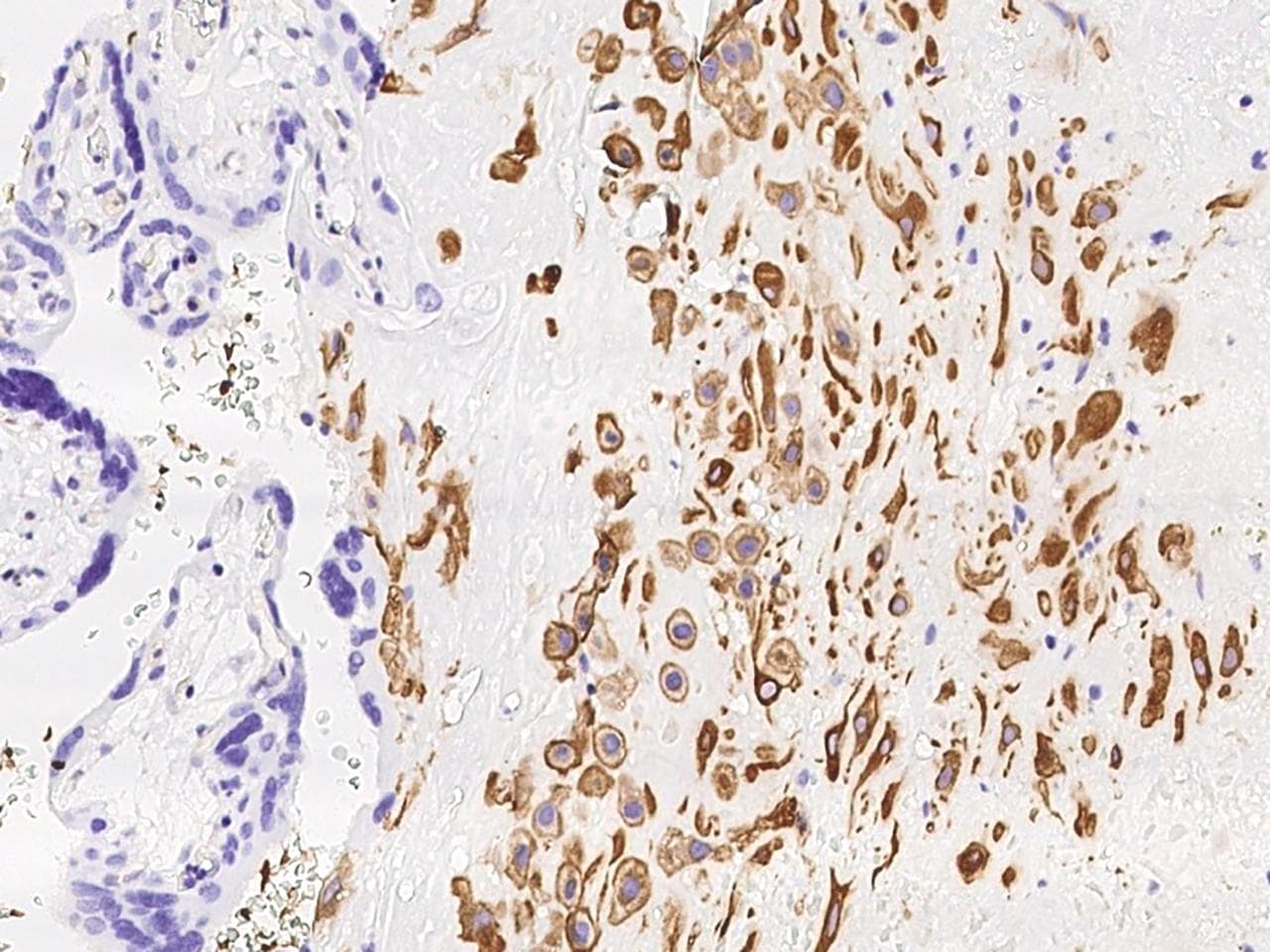 Polyclonal Rabbit anti-Human MXRA7 Antibody (IHC, IF)