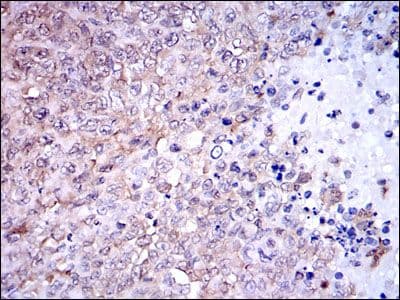 NQO1 Antibody (clone 4D12)