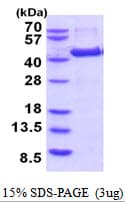 Human AMT Protein (Recombinant His)