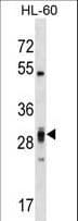 Polyclonal Rabbit anti-Human PLEKHF2 Antibody (aa71-98, WB)