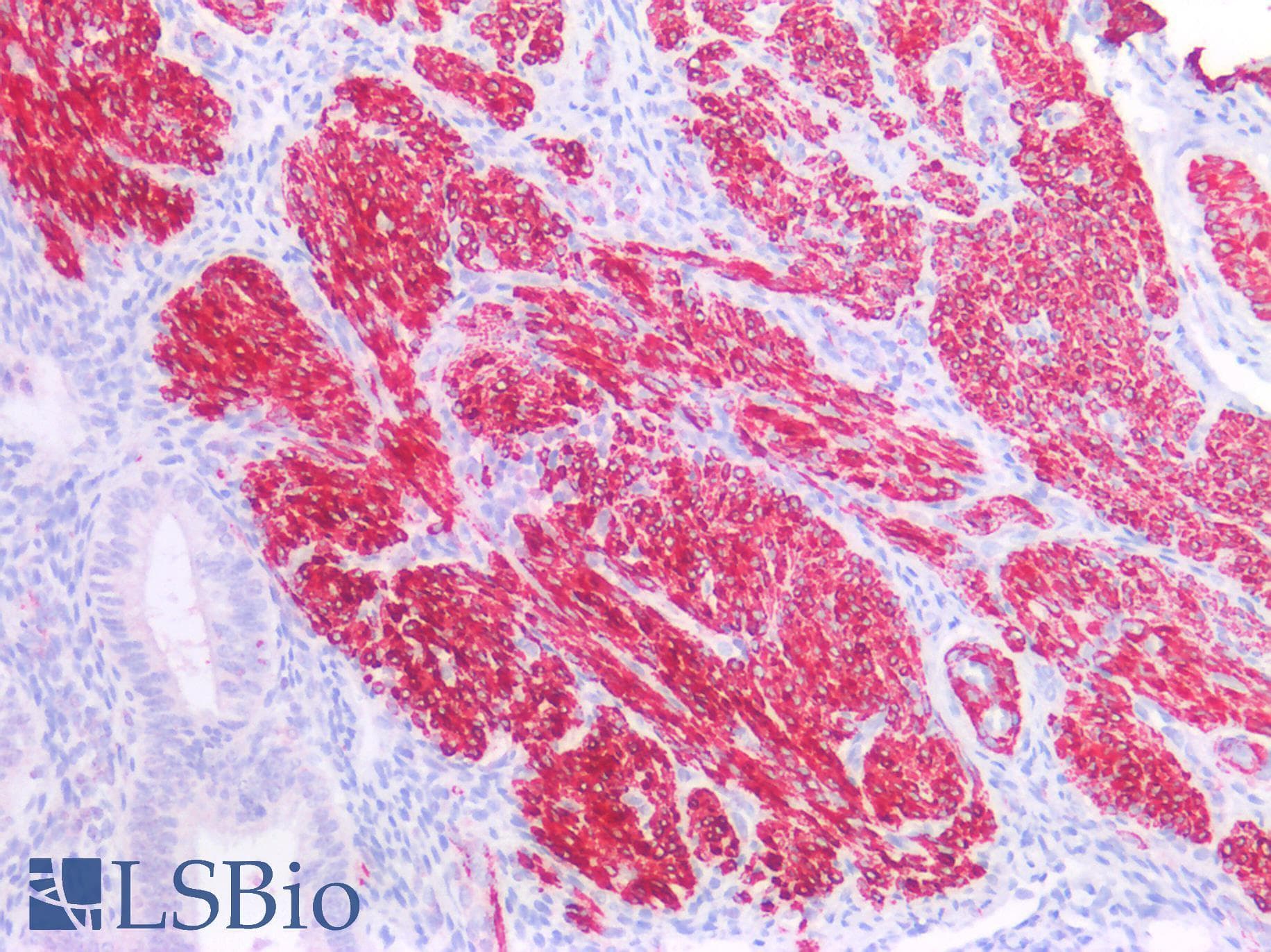PathPlus™ ACTA2 / Smooth Muscle Actin Antibody (clone AT132D3)