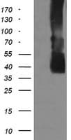 Monoclonal Mouse anti-Human MAP2K3 / MEK3 / MKK3 Antibody (clone OTI1H6, IHC, IF, WB)