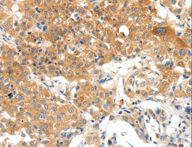 Polyclonal Rabbit anti-Human PLAT / TPA Antibody (IHC, WB)