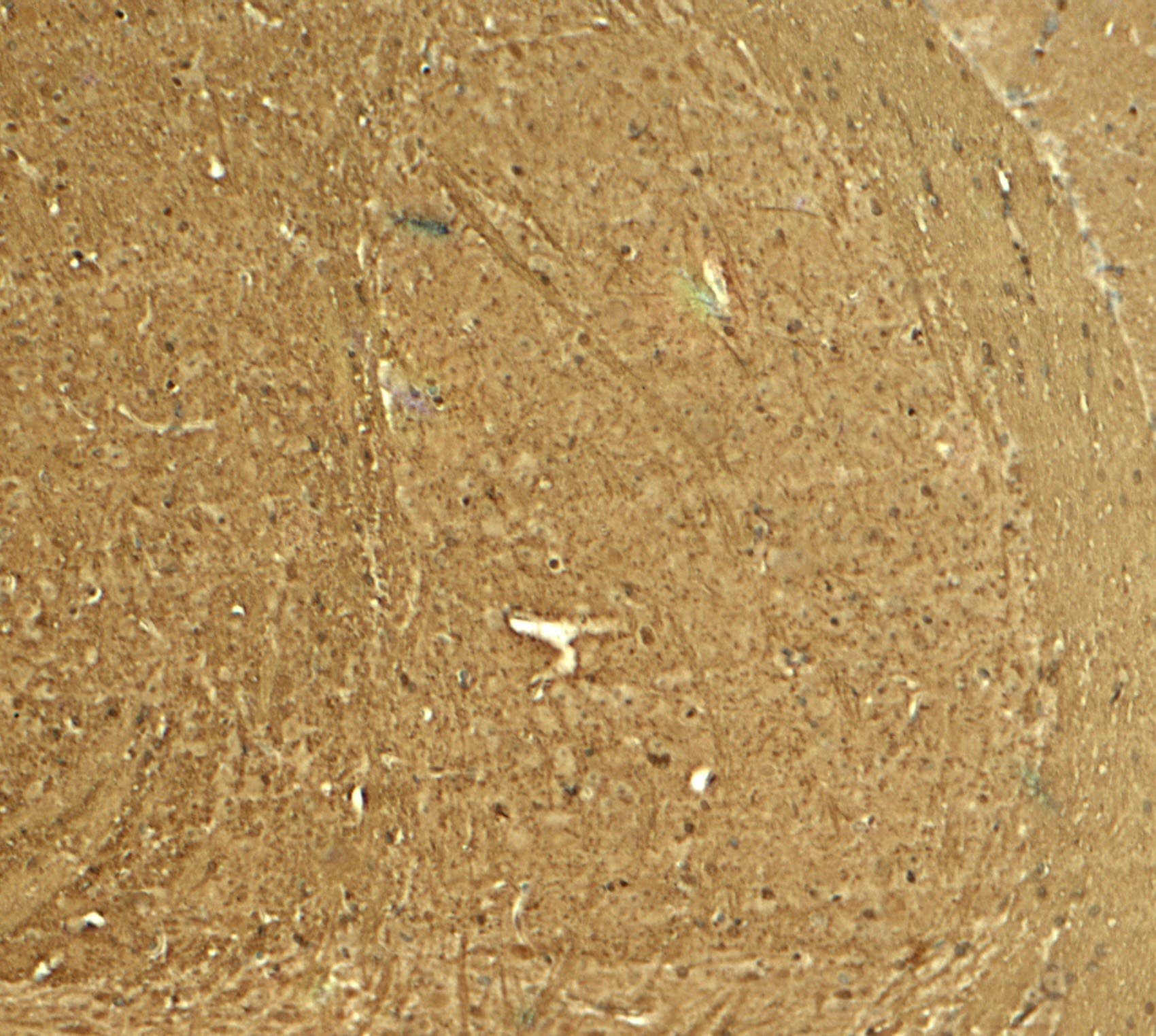 IHC-plus™ PTPN5 / STEP Antibody