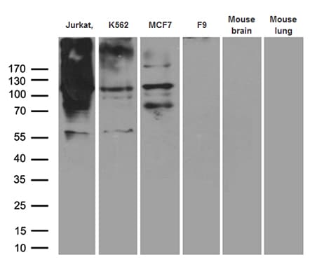 RB1 / Retinoblastoma / RB Antibody (aa309-590, clone OTI13A6)