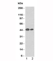 KRT18 / CK18 / Cytokeratin 18 Antibody (clone SPM265, Azide-free, BSA-free)