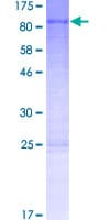 Human ZBED5 Protein (Recombinant GST)