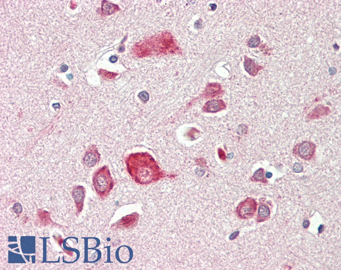 IHC-plus™ Monoclonal Mouse anti-Human SYN / FYN Antibody (clone 2A10, IHC, IF, WB)