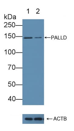 PALLD / Palladin Antibody (aa1137-1383)