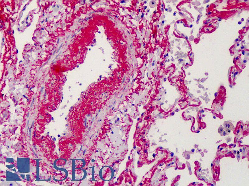 IHC-plus™ Polyclonal Rabbit anti-Human ELN / Elastin Antibody (IHC, IF)
