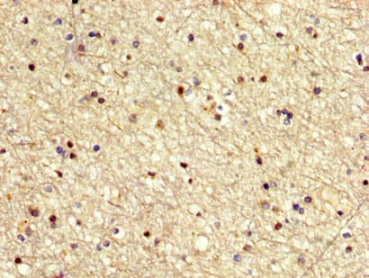 Polyclonal Rabbit anti-Human MECOM / EVI1 Antibody (IHC)