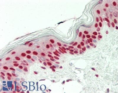 IHC-plus™ Polyclonal Rabbit anti-Human POM121 Antibody (C-Terminus, IHC, WB)