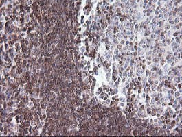 Monoclonal Mouse anti-Human DEF6 Antibody (clone OTI1E3, IHC, IF, WB)