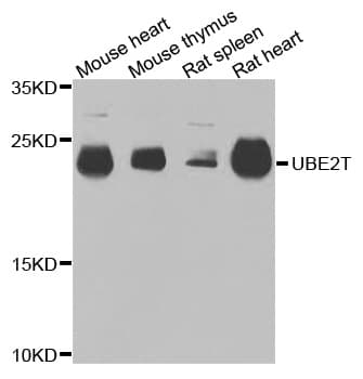 UBE2T / HSPC150 Antibody
