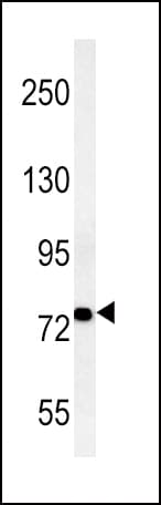 Polyclonal Rabbit anti-Human ACSL4 / FACL4 Antibody (aa236-267, IHC, IF, WB)