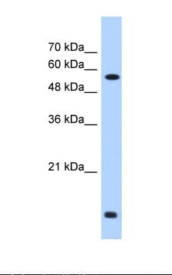 PDI / P4HB Antibody (C-Terminus)
