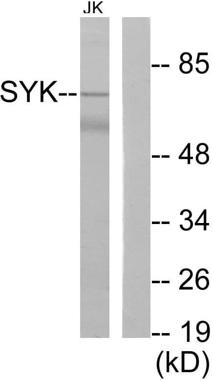 SYK Antibody (aa314-363)