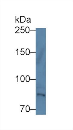 TEC Antibody (aa370-623, APC)