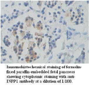 Polyclonal Rabbit anti-Human INPP1 Antibody (aa130-352, IHC)