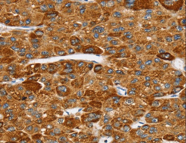 SPARCL1 / Hevin Antibody