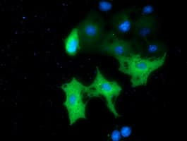 MTMR14 Antibody (clone OTI6B6)