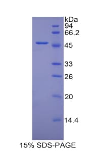 Mouse PECAM-1 / CD31 Protein (Recombinant His-GST)