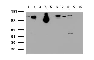 Monoclonal Mouse anti-Human NCAM / CD56 Antibody (clone UMAB83, aa20-718, IHC, WB)