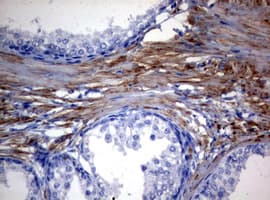 MFN1 Antibody (clone OTI4D11)