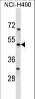 Polyclonal Rabbit anti-Human KCNK12 Antibody (aa335-364, WB)