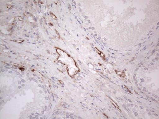 Monoclonal Mouse anti-Human PROCR / EPCR Antibody (clone OTI12H5, aa1-210, IHC, WB)