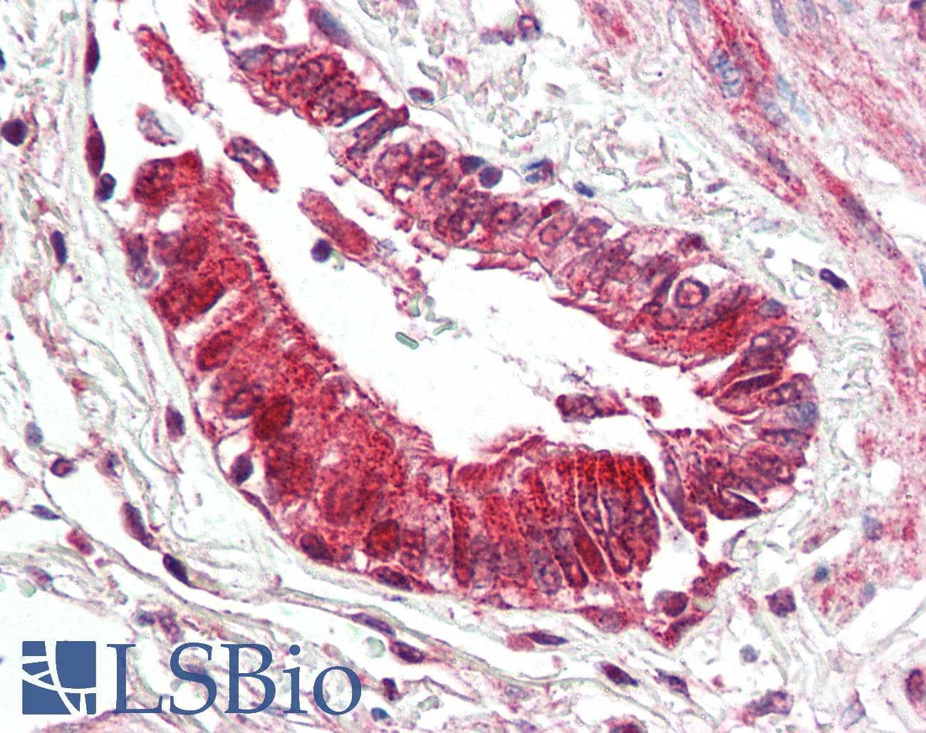 PathPlus™ BECN1 / Beclin-1 Antibody
