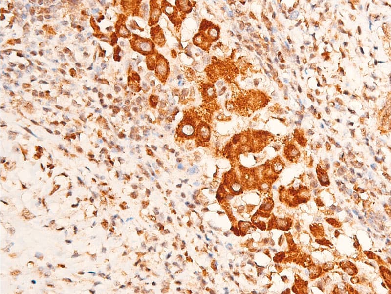 Polyclonal Rabbit anti-Human CHEK1 / CHK1 Antibody (phospho-Ser296, IHC, IF, WB)