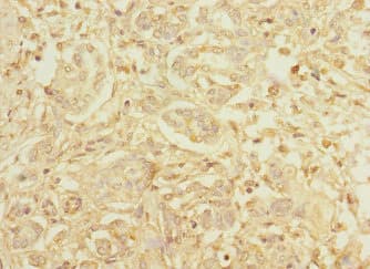 Polyclonal Rabbit anti-Human HEPH / Hephaestin Antibody (IHC, WB)
