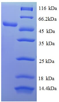 Human RPL18 / Ribosomal Protein L18 (Recombinant GST)