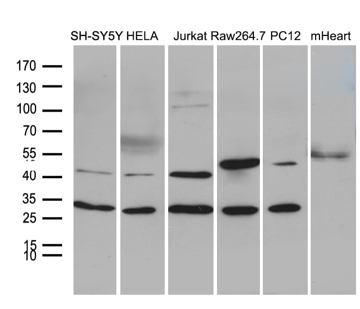 DNAJB6 Antibody (clone OTI5B5)