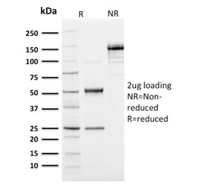 Ubiquitin Antibody (clone UBB/1748)