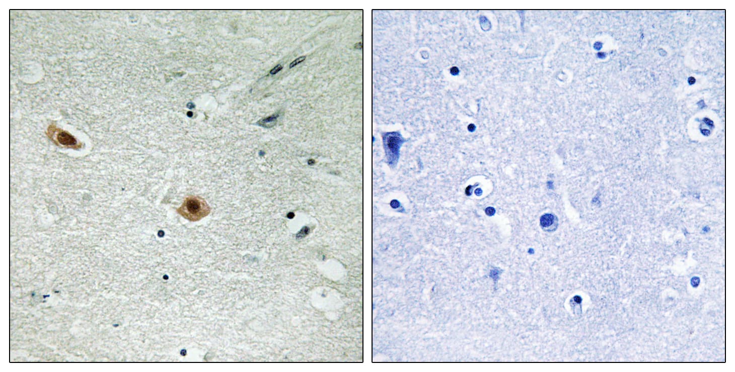 RB1 / Retinoblastoma / RB Antibody (phospho-Ser608)