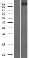 DIP2C Protein (Over-Expression Lysate Myc-DDK (Flag))