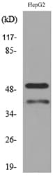 Polyclonal Rabbit anti-Human LASP1 Antibody (WB)