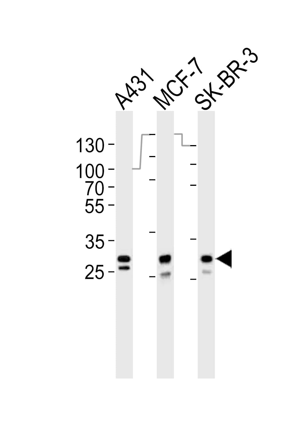 CTSD / Cathepsin D Antibody (aa241-273)