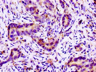 SLC11A2 / DMT1 Antibody