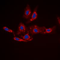 CTNNB1 / Beta Catenin Antibody (phospho-Ser33)