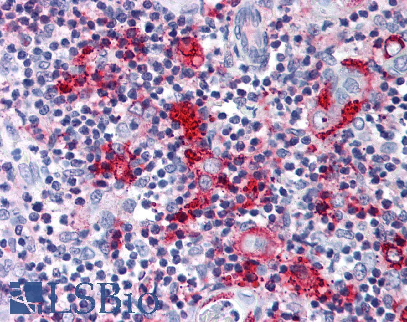 IHC-plus™ CCR9 / CD199 Antibody (Extracellular Domain)