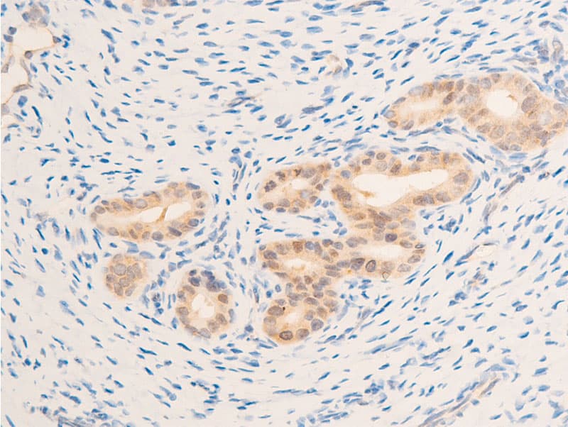 EGFR Antibody (phospho-Ser1071)