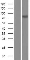 ZBTB33 / Kaiso Protein (Over-Expression Lysate Myc-DDK (Flag))