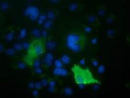 IHC-plus™ ARHGAP25 Antibody (clone 12G4)