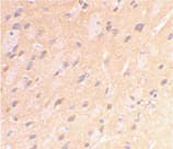 APP / Beta Amyloid Precursor Antibody