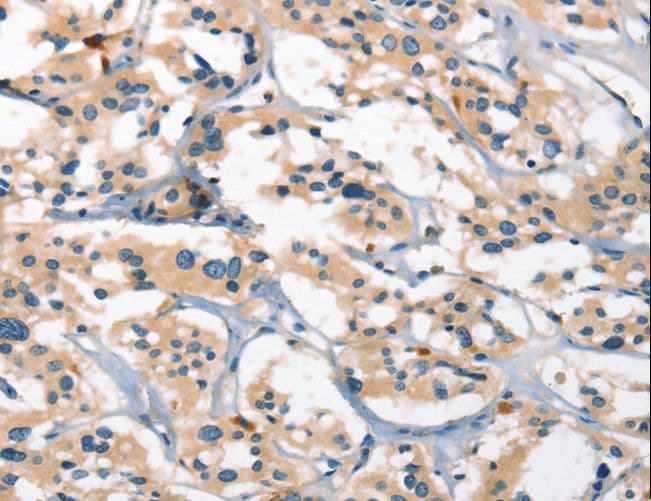 GPR182 / ADMR Antibody