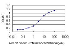 IHC-plus™ HDAC1 Antibody (clone 1D6)
