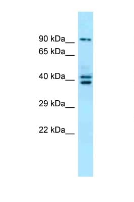 L3MBTL3 Antibody (N-Terminus)